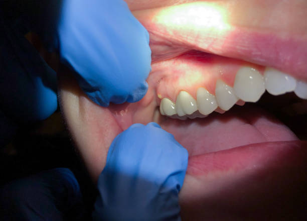 Best Pediatric Emergency Dentist in Tabor City, NC