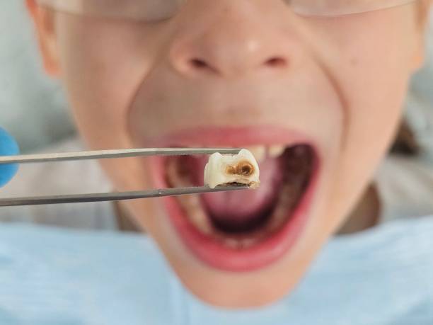 Best Emergency Treatment for Toothache in Tabor City, NC